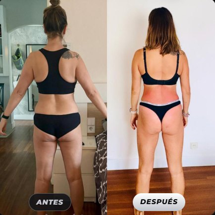 Antes y después de una clienta de Renace Fit